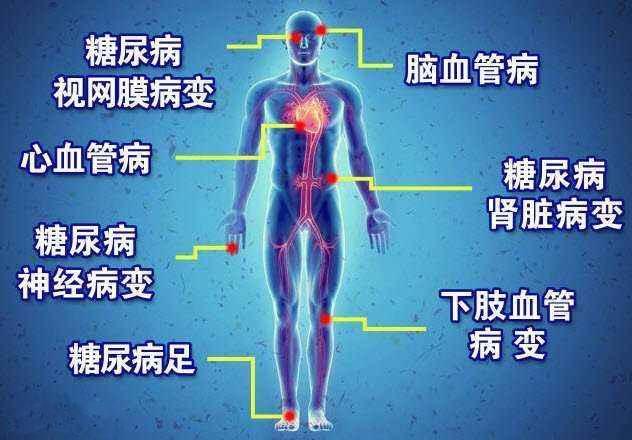 <a href='http://www.zksip.com/ktzs/tnbbfz/' target='_blank'><u>糖尿病并发症</u></a>